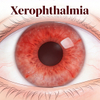 Mod&egrave;les de x&eacute;rophtalmie de souris (œil sec)