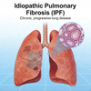 Mod&egrave;les de fibrose pulmonaire idiopathique (FPI) chez les rongeurs