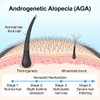 Model Androgenetic Alopecia (AGA) Tikus