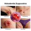 Modely NHP Hidradenitis Suppurativa (HS).