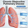 Modelos de doen&ccedil;a pulmonar obstrutiva cr&ocirc;nica (DPOC) do NHP